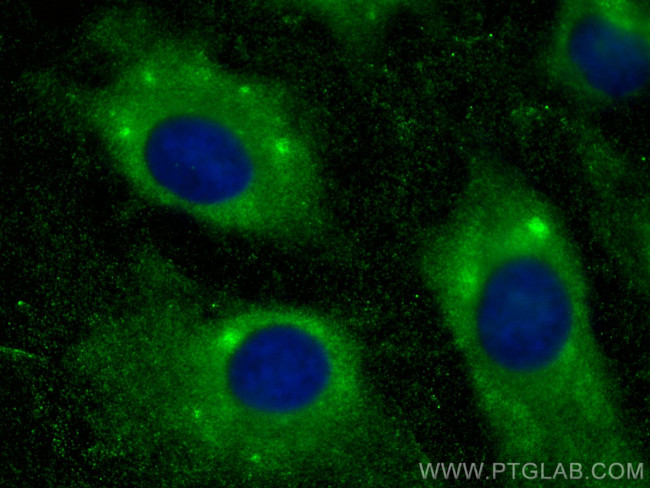 MYL6 Antibody in Immunocytochemistry (ICC/IF)