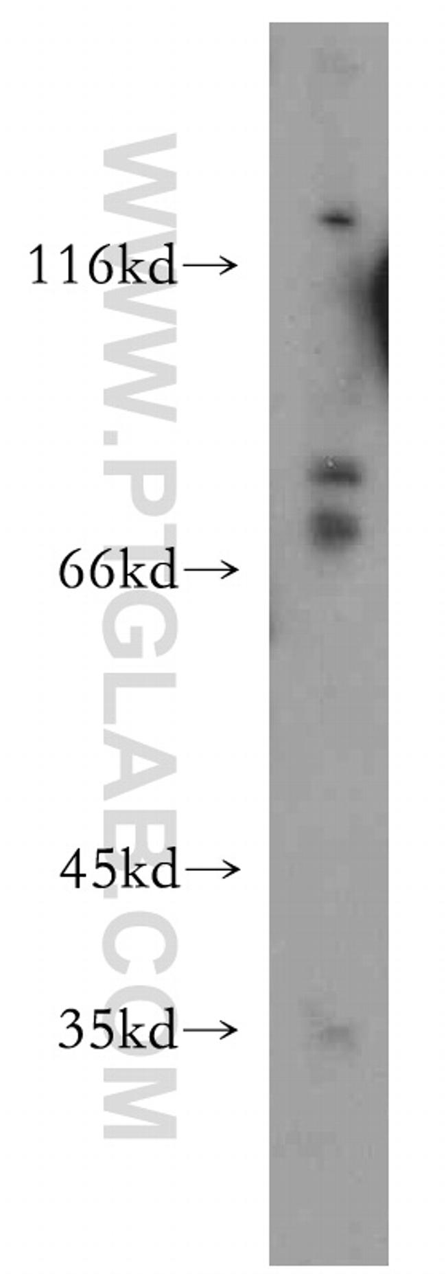 AXUD1 Antibody in Western Blot (WB)
