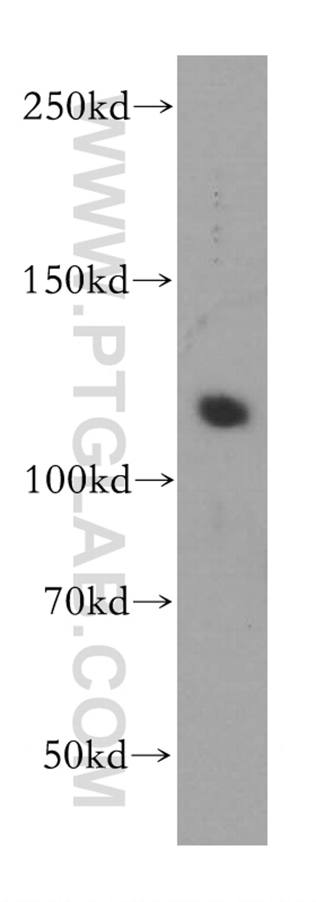 PMS2 Antibody in Western Blot (WB)