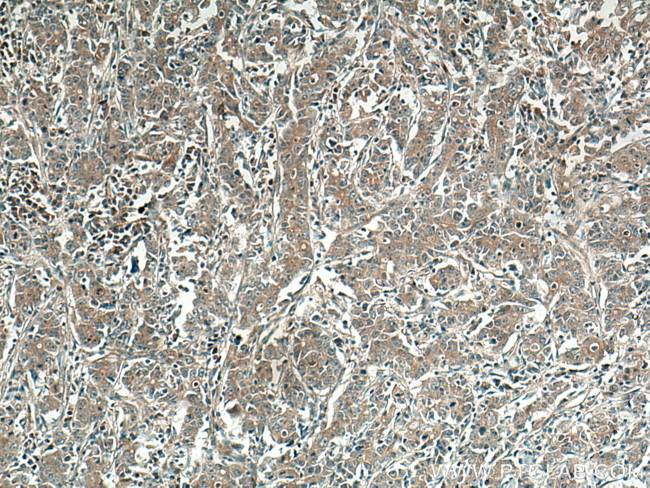 WISP1 Antibody in Immunohistochemistry (Paraffin) (IHC (P))