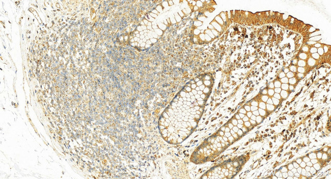 RNASE2 Antibody in Immunohistochemistry (Paraffin) (IHC (P))
