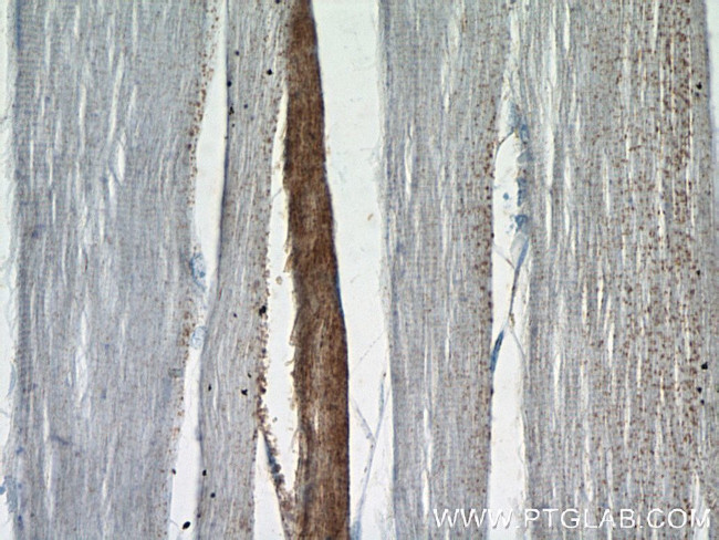 RBM24 Antibody in Immunohistochemistry (Paraffin) (IHC (P))