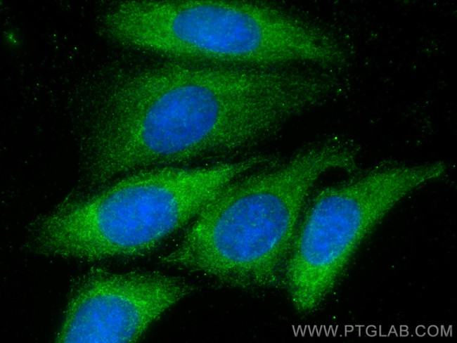 SLC28A3 Antibody in Immunocytochemistry (ICC/IF)