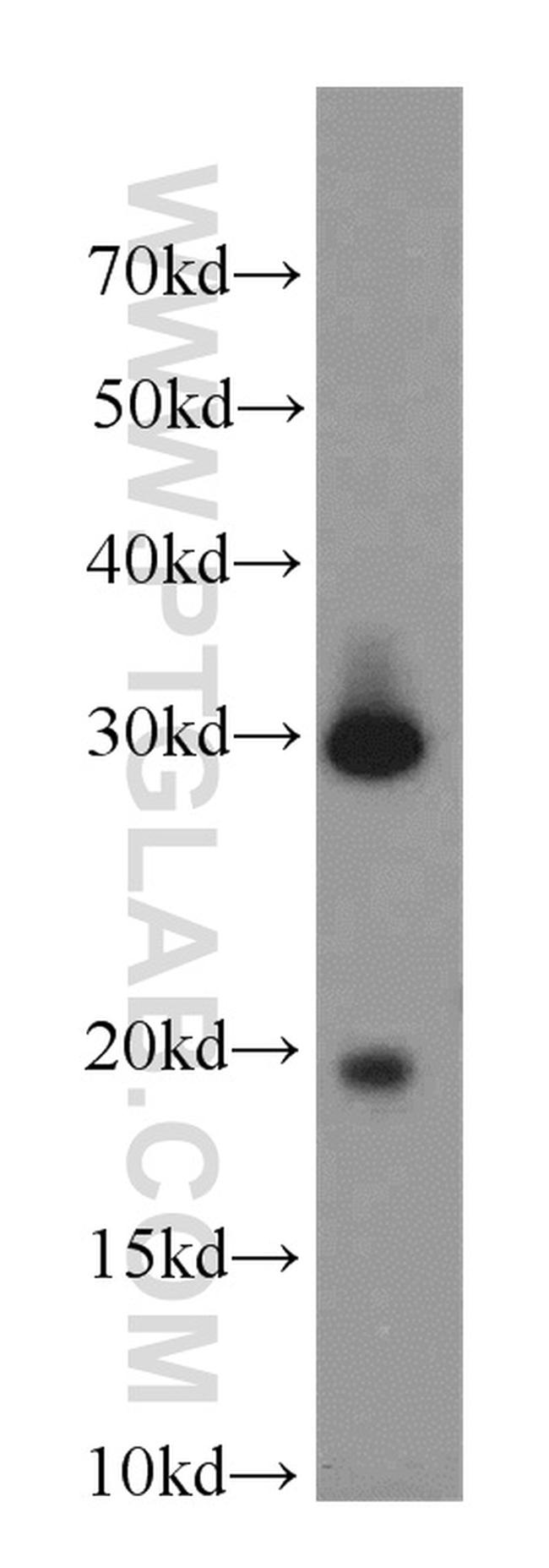CST8 Antibody in Western Blot (WB)