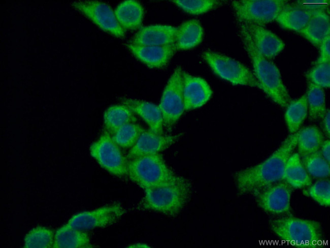 LACTB Antibody in Immunocytochemistry (ICC/IF)