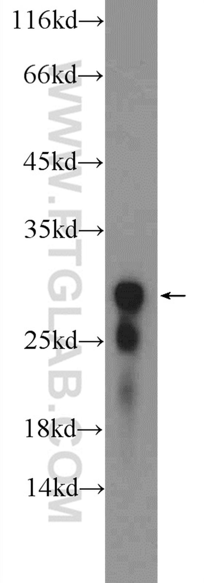 Histone H1 Antibody in Western Blot (WB)