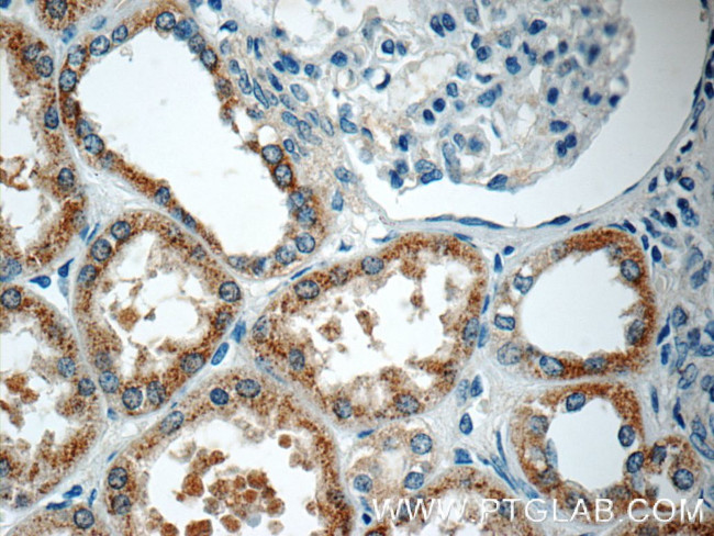 PPM1L Antibody in Immunohistochemistry (Paraffin) (IHC (P))