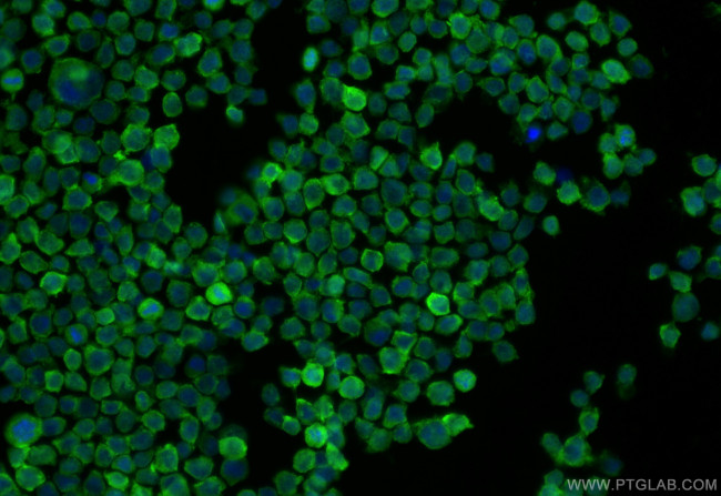DYSFIP1 Antibody in Immunocytochemistry (ICC/IF)
