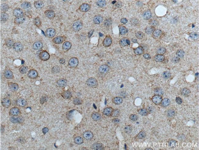 GRM8 Antibody in Immunohistochemistry (Paraffin) (IHC (P))
