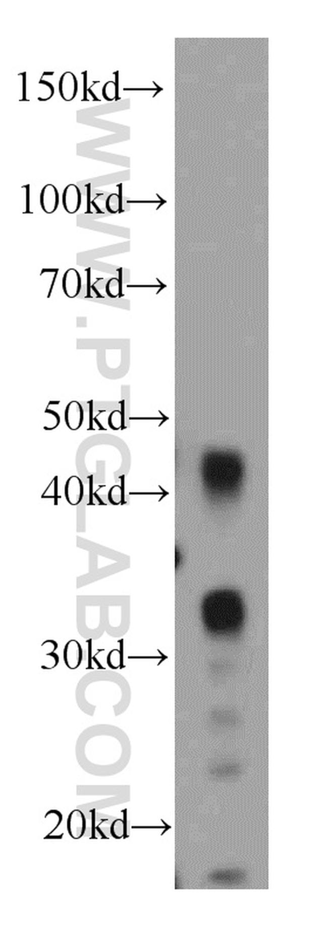 HUS1B Antibody in Western Blot (WB)