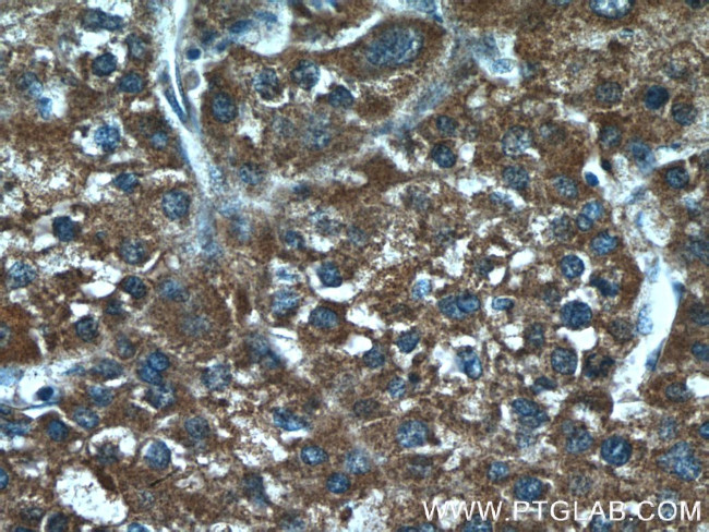 TM4SF5 Antibody in Immunohistochemistry (Paraffin) (IHC (P))