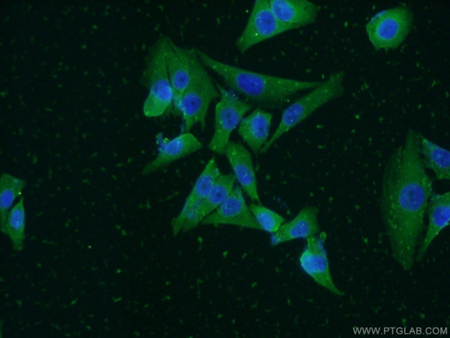 PHLDA1 Antibody in Immunocytochemistry (ICC/IF)