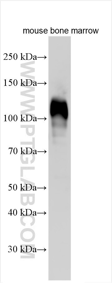 CD177 Antibody in Western Blot (WB)