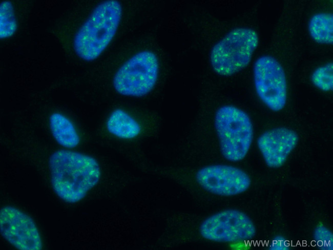 Pinin Antibody in Immunocytochemistry (ICC/IF)