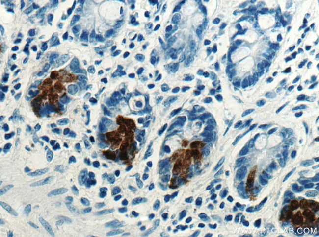 DEFA5 Antibody in Immunohistochemistry (Paraffin) (IHC (P))