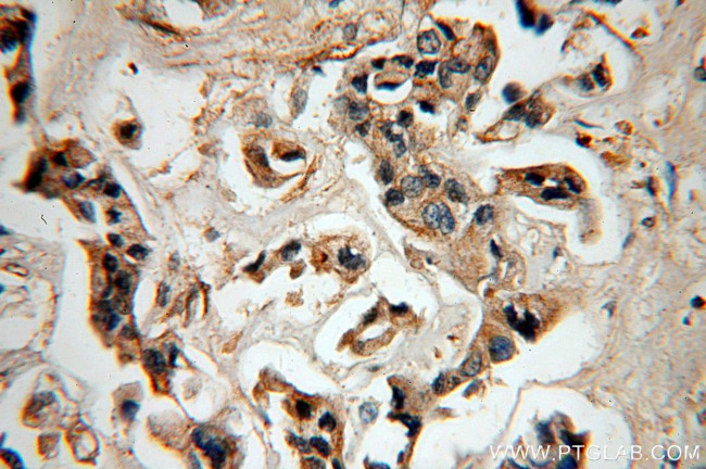 LACRT Antibody in Immunohistochemistry (Paraffin) (IHC (P))
