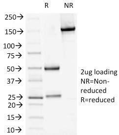 Desmoglein-1 (DSG1) Antibody in SDS-PAGE (SDS-PAGE)