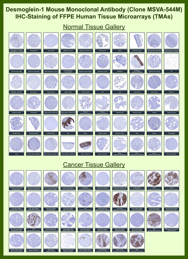Desmoglein-1 (DSG1) Antibody in Immunohistochemistry (Paraffin) (IHC (P))