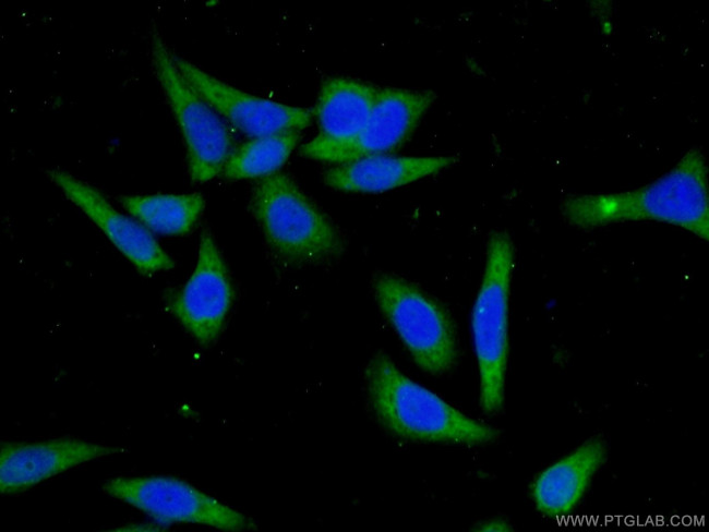 CCDC85B Antibody in Immunocytochemistry (ICC/IF)