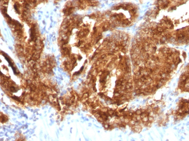 TAG-72/CA72.4 (Tumor-Associated Glycoprotein) Antibody in Immunohistochemistry (Paraffin) (IHC (P))