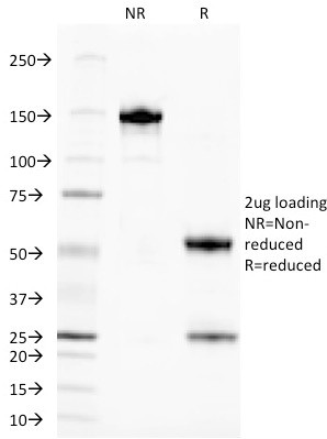 TAG-72/CA72.4 (Tumor-Associated Glycoprotein) Antibody in SDS-PAGE (SDS-PAGE)