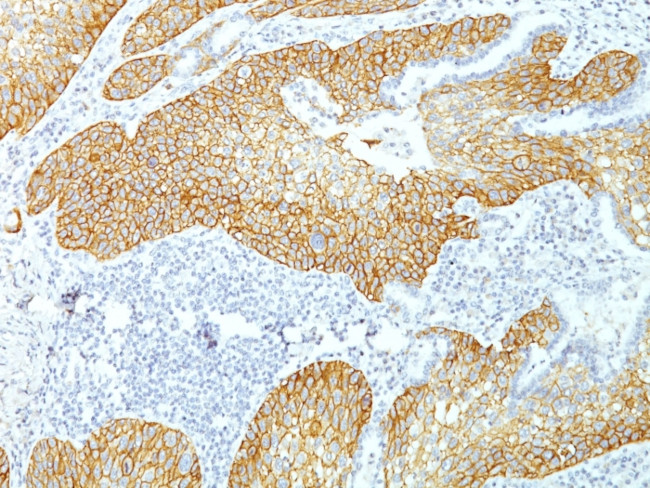 Desmoglein-3 Antibody in Immunohistochemistry (Paraffin) (IHC (P))