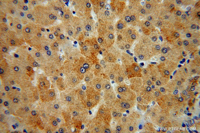 ITM2A Antibody in Immunohistochemistry (Paraffin) (IHC (P))