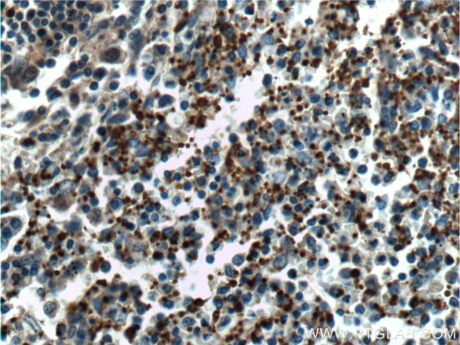 CD41/Integrin alpha 2b Antibody in Immunohistochemistry (Paraffin) (IHC (P))