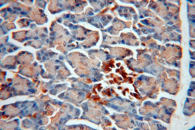 ERO1LB Antibody in Immunohistochemistry (Paraffin) (IHC (P))