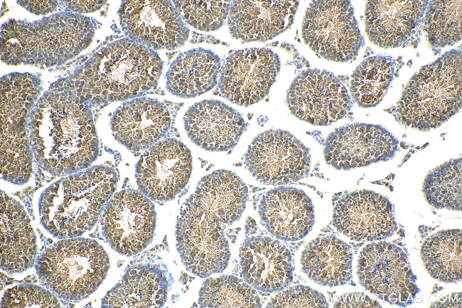 FBXW5 Antibody in Immunohistochemistry (Paraffin) (IHC (P))