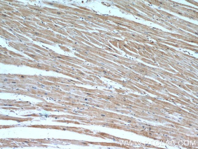 PHD3 Antibody in Immunohistochemistry (Paraffin) (IHC (P))