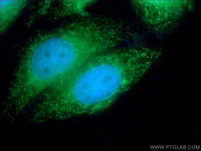 PIGS Antibody in Immunocytochemistry (ICC/IF)