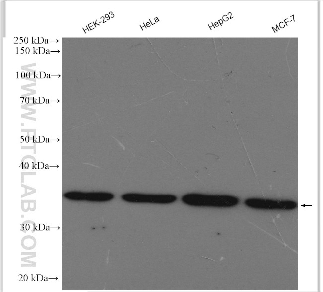 MRPL15 Antibody in Western Blot (WB)