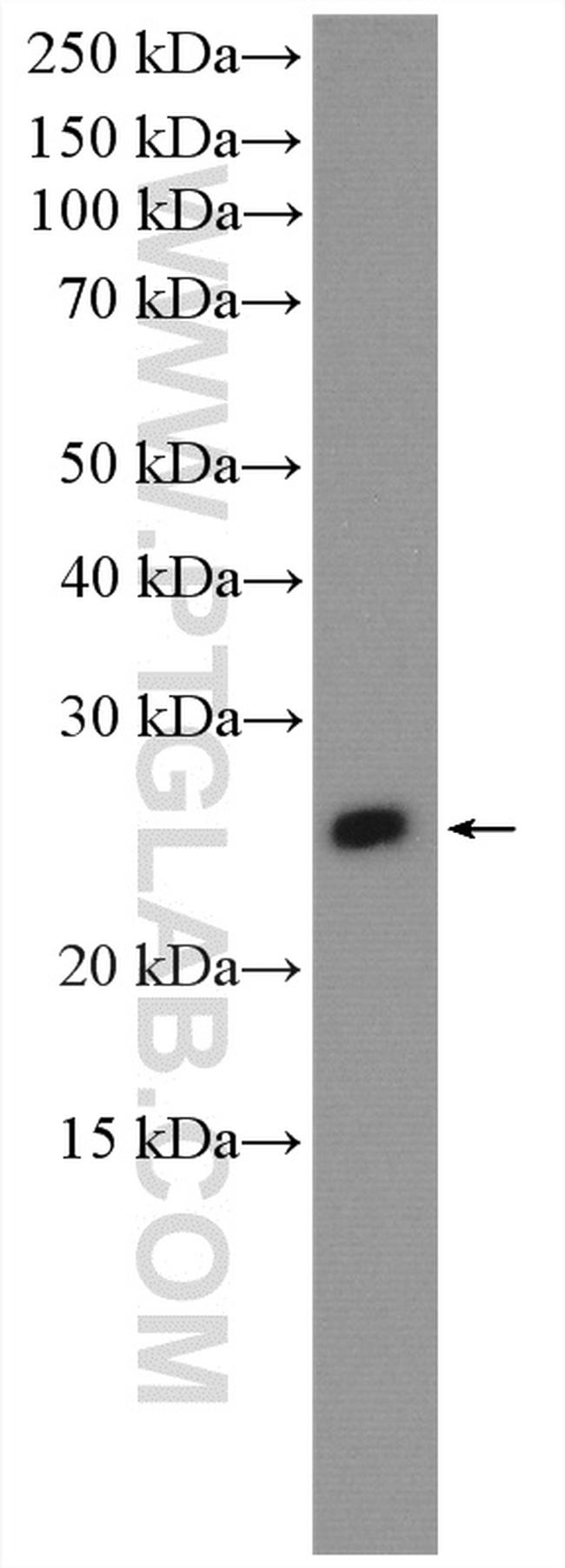 IGLV6-57 Antibody in Western Blot (WB)