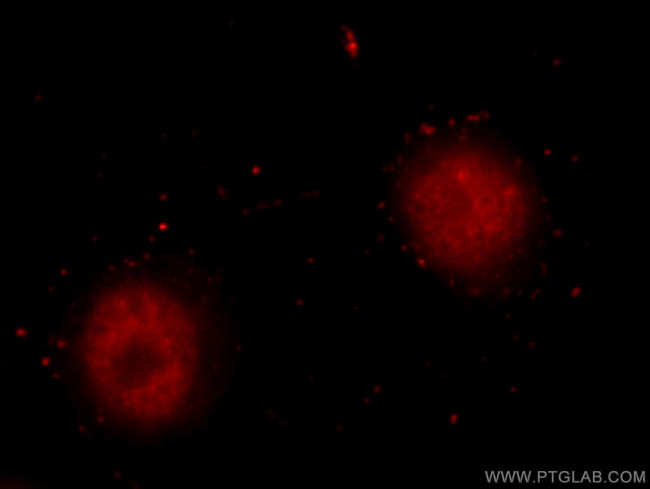 HNRNPL Antibody in Immunocytochemistry (ICC/IF)