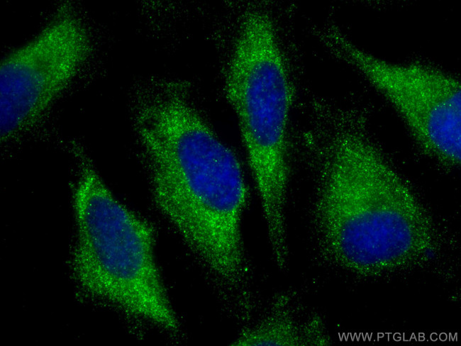 PLD1 Antibody in Immunocytochemistry (ICC/IF)