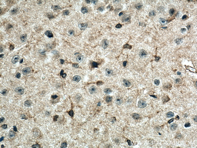 Orexin receptor 1 Antibody in Immunohistochemistry (Paraffin) (IHC (P))