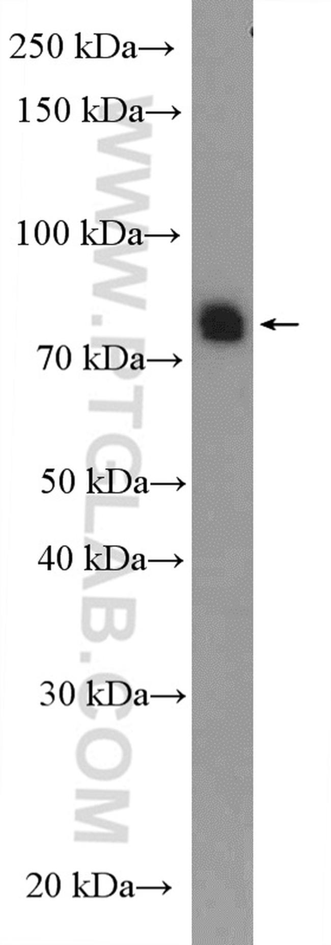 SPATA20 Antibody in Western Blot (WB)