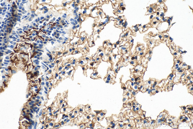 SLC6A14 Antibody in Immunohistochemistry (Paraffin) (IHC (P))