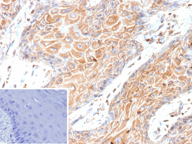 HBEGF/DTR Antibody in Immunohistochemistry (Paraffin) (IHC (P))