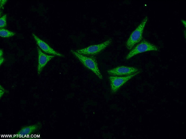 FASTKD3 Antibody in Immunocytochemistry (ICC/IF)
