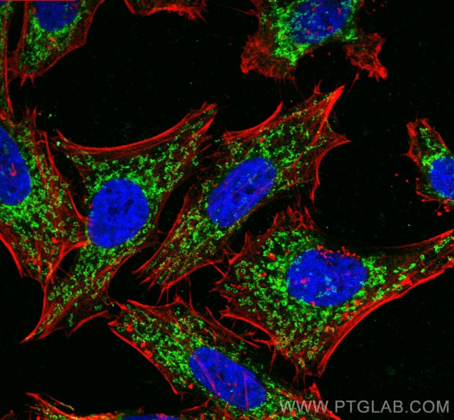TOMM40 Antibody in Immunocytochemistry (ICC/IF)
