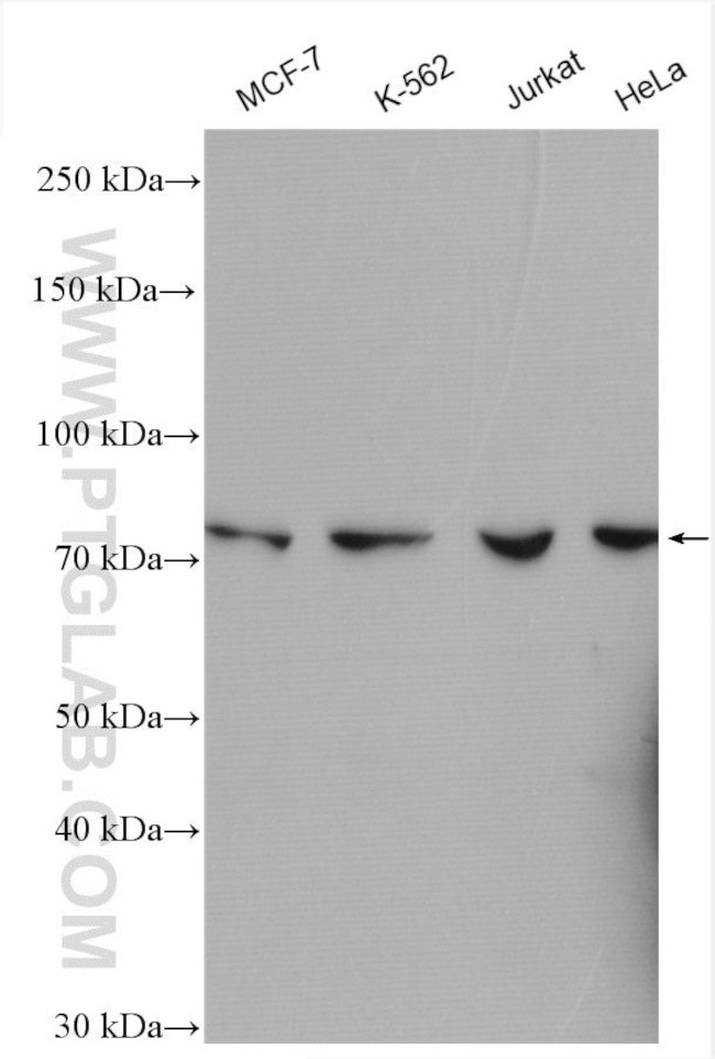 SPATA5L1 Antibody in Western Blot (WB)