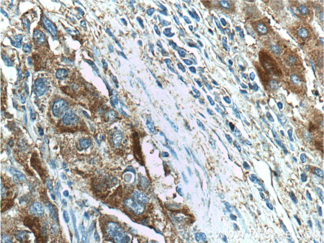 FAM84B Antibody in Immunohistochemistry (Paraffin) (IHC (P))