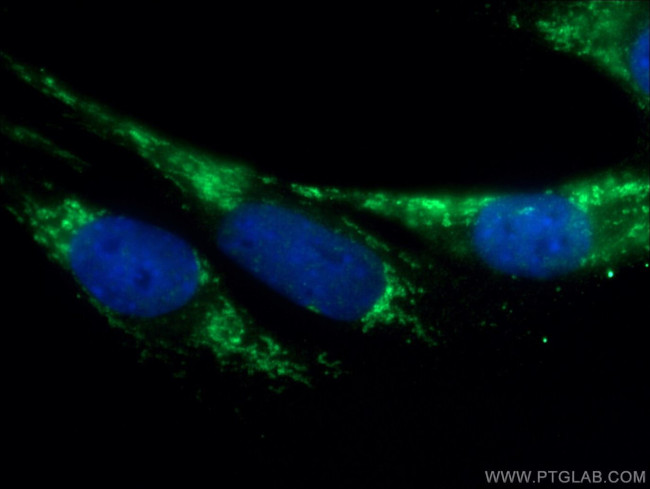 Calsequestrin 2 Antibody in Immunocytochemistry (ICC/IF)