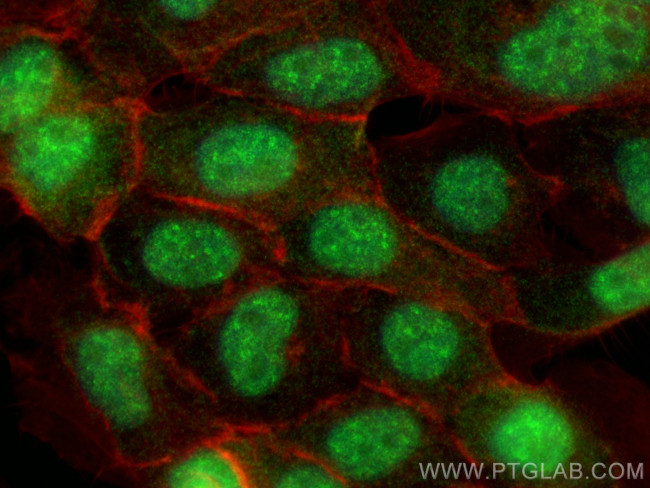 RPP30 Antibody in Immunocytochemistry (ICC/IF)