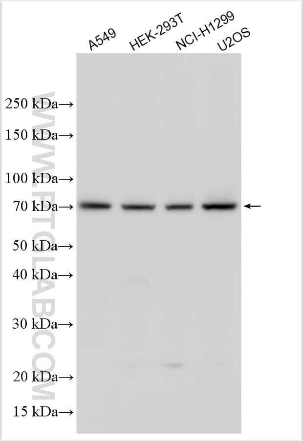 CYBA Antibody in Western Blot (WB)