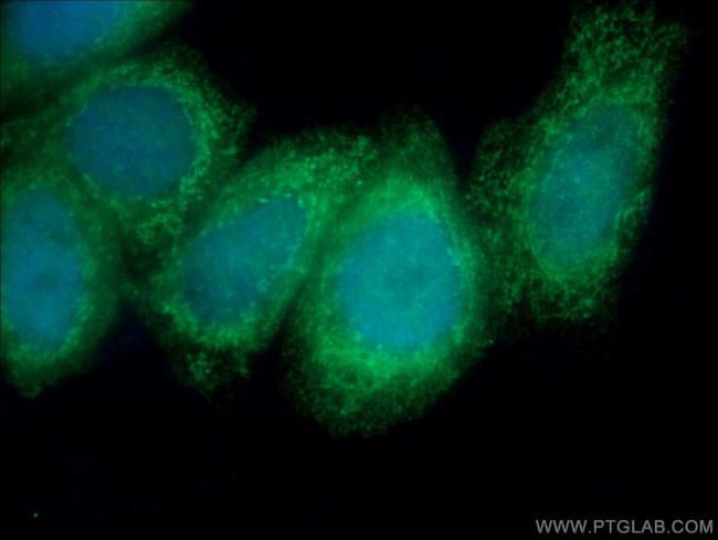 MRPS30 Antibody in Immunocytochemistry (ICC/IF)