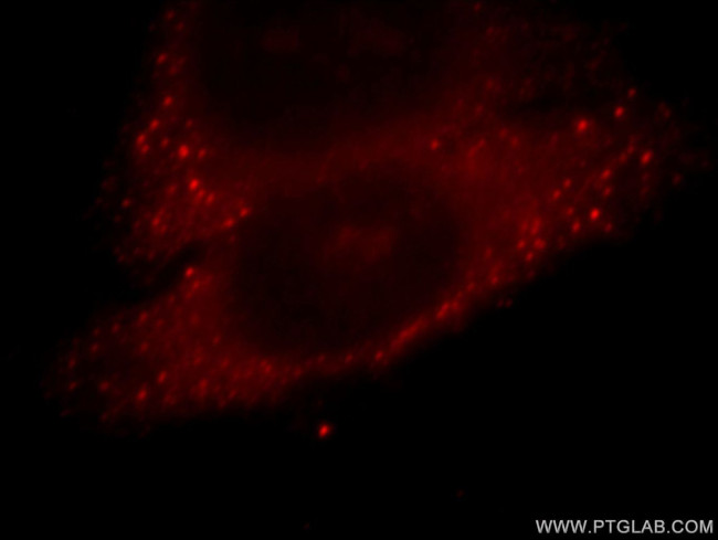 TRIM41 Antibody in Immunocytochemistry (ICC/IF)