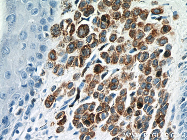 MLANA Antibody in Immunohistochemistry (Paraffin) (IHC (P))